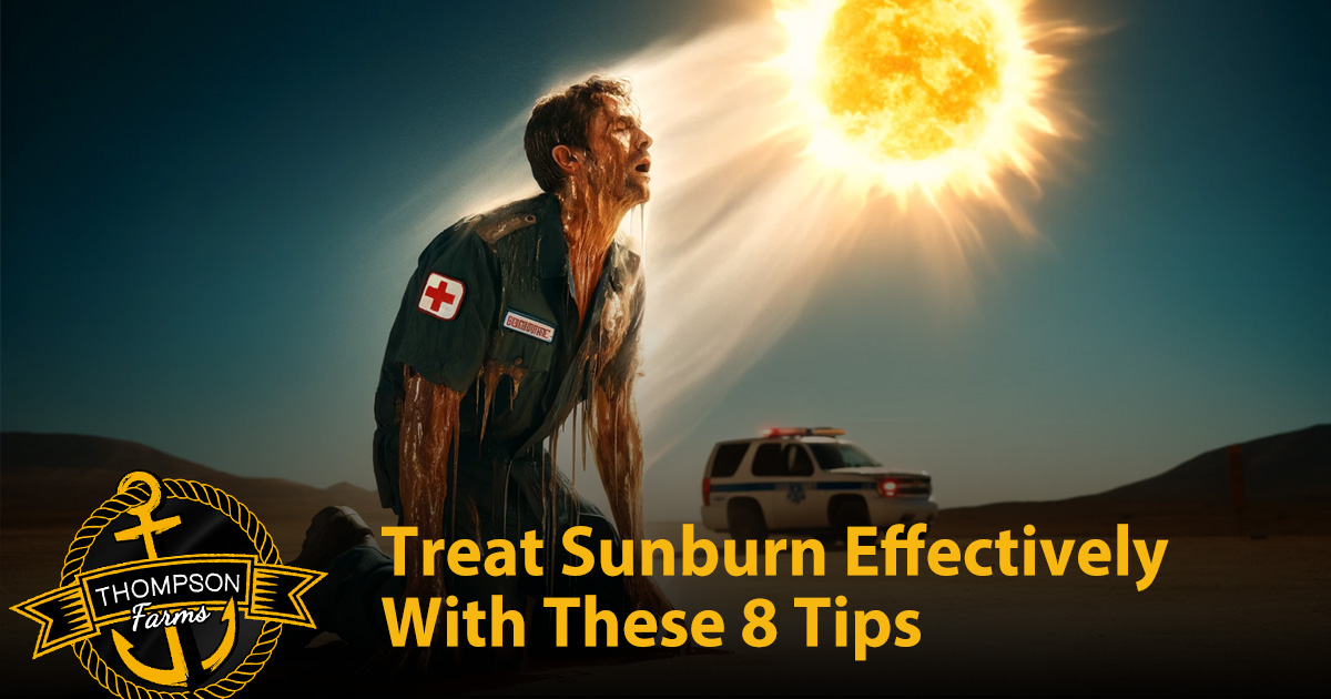 Treat Sunburn Effectively With These 8 Tips, Nashville